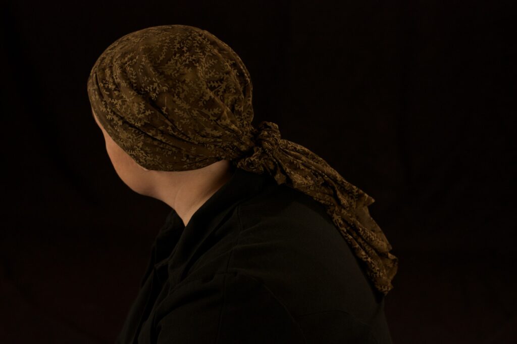 Woman wearing head scarf for Hair Loss 