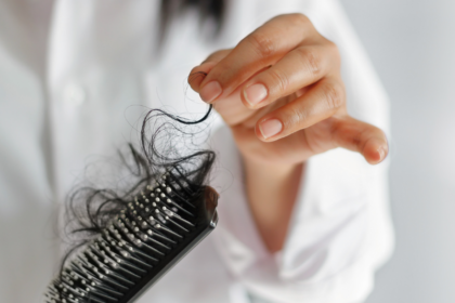 Picture of Hair Loss in Brush